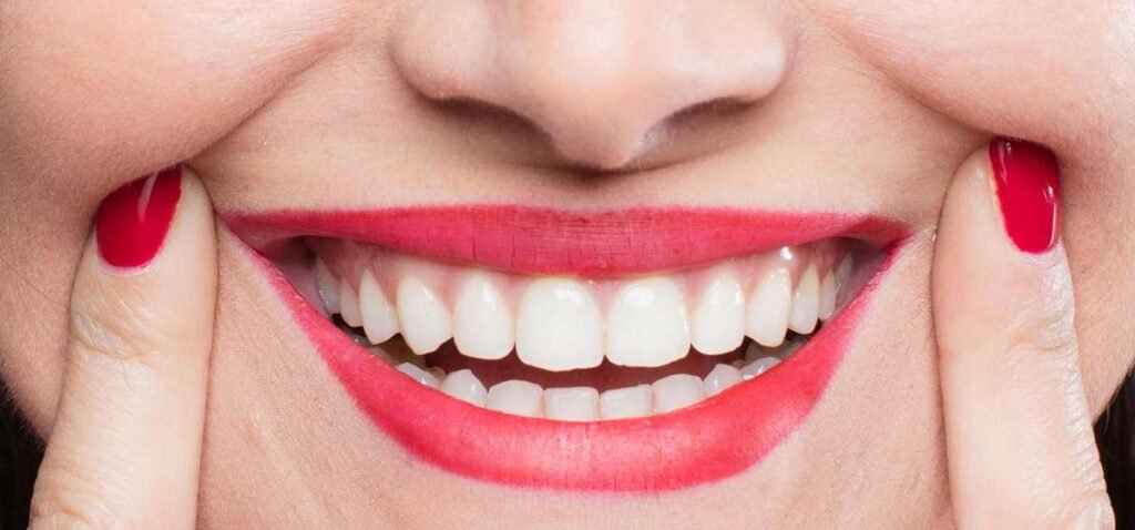 Smile Designing and Veener Treatment