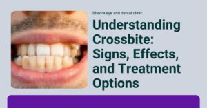 Understanding Crossbite: Signs, Effects, and Treatment Options